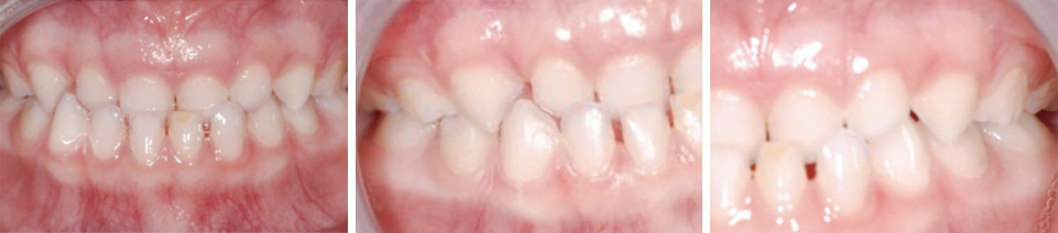 Mon Ortho sur le Plateau