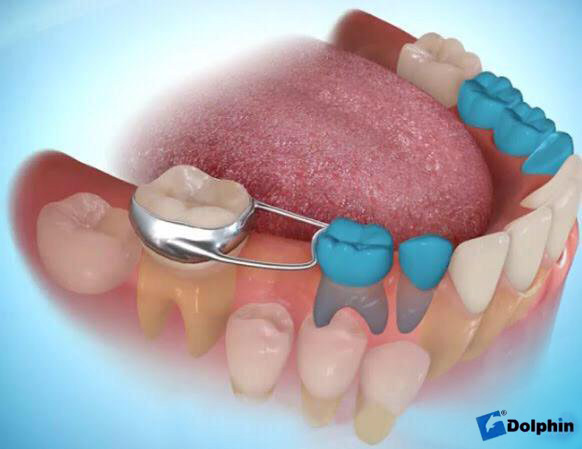 Mon Ortho sur le Plateau